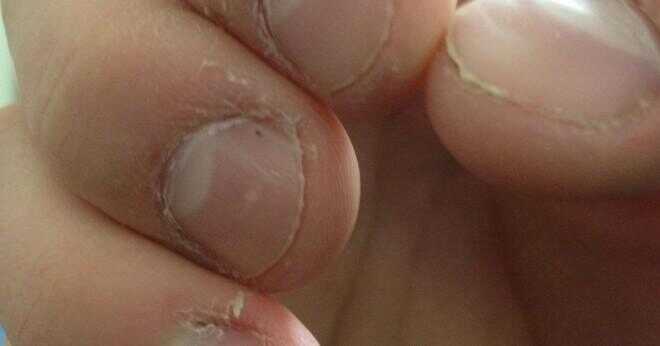 Nagellack kan skada dina naglar?