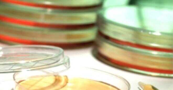 Användning av färgning burk i mikrobiologi?