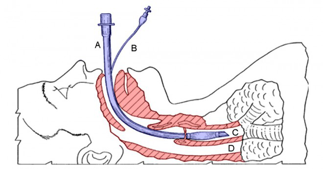 Vad heter röret mellan halsen och lungorna?