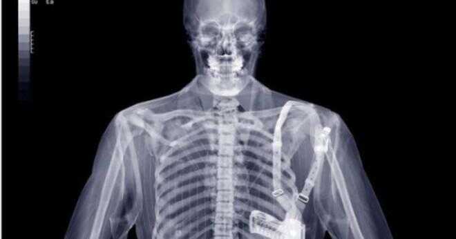 Vem äger röntgen tas av en läkare och betalas av sjukförsäkring läkaren eller patienten?