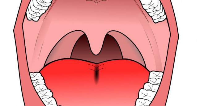 Hur lång är sjukhusvistelsen för en tonsillektomi?