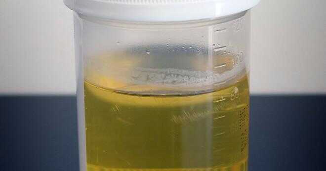 Kan blekmedel rödfärgad urin?