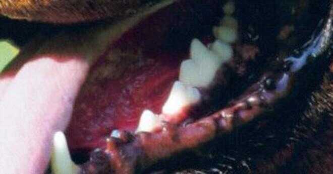 Vad den hård yta av tanden består av?