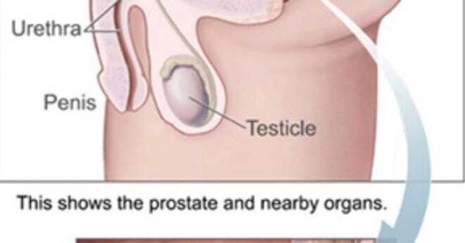 Vad är den medicinska termen betyder inflammationen i prostatan?