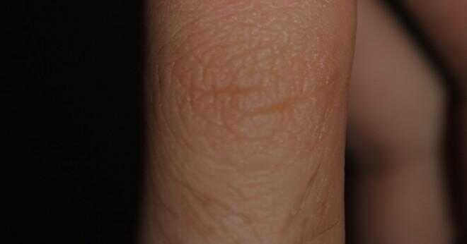 Vad som kan orsaka en tunn blå linje över hela naglarna?