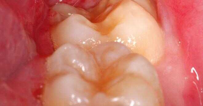 Vad är funktionen av rotkanalen i en tand?