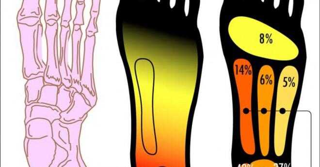 Vad är en inflammation i plantar fascia som orsakar smärta i foten och hälen när man går?