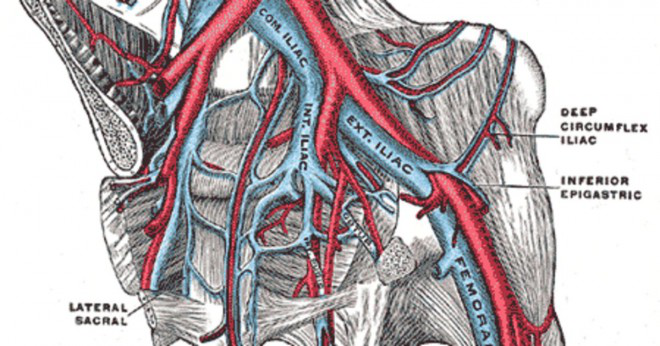 Lungemboli vägen av en blodpropp från benet till lungorna?
