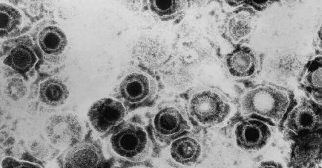 Kan påverka herpesviruset halsen?