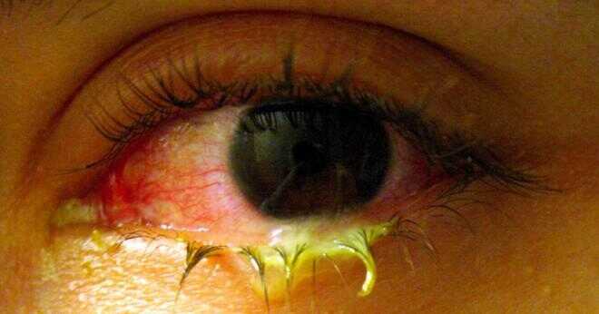 Kan orsaka avföring rosa öga?