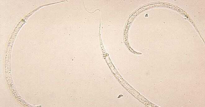 Varför Dracunculus Medinensis infektion kallas guinea worm sjukdom?