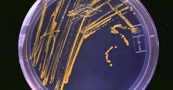 Hur länge kan agar vara inne i en petriskål med inga bakterier växer på den?
