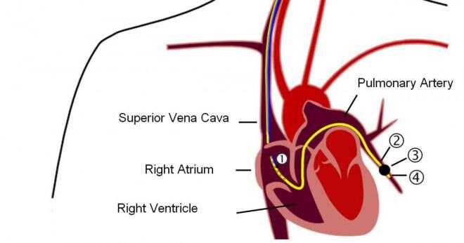 Hur långa är dina vener artärer och kapillärer?