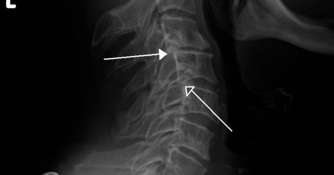 Vad heter röntgen av ryggmärgen?