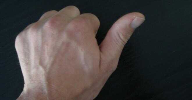 Är tummen är distalt rätt finger?