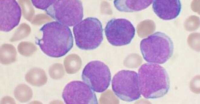Hur påverkas ammune systemet av leukemi?