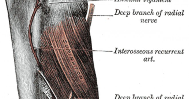 Kan orsaka karpaltunnelsyndrom nacken smärta?