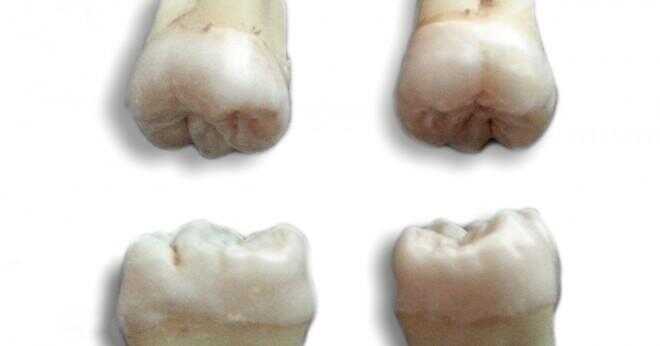 Molar tänder och smärta när de börja växa?