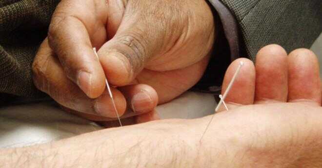Vad kineserna använde akupunktur för?
