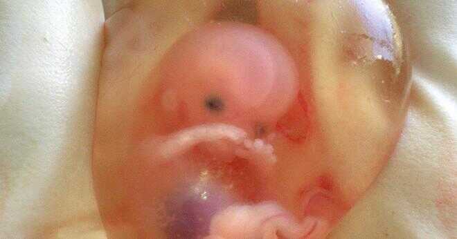 Vilket skede av graviditeten embryot dela upp om det är tvillingar?